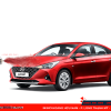 Sơn xe Hyundai Accent tại Auto365 Quận 9