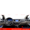 Dán PPF nội thất xe Hyundai Accent tại Auto365 Quận 9